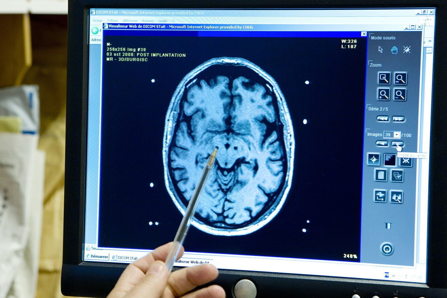 La radiografia di un cervello