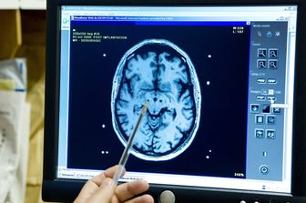 La radiografia di un cervello