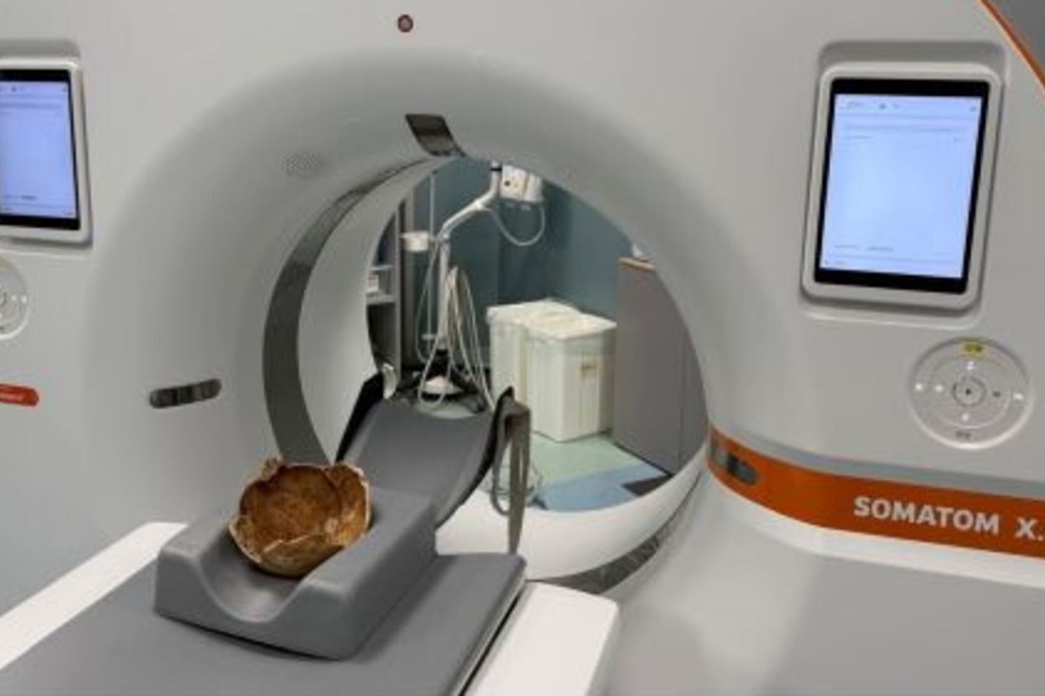 L'analisi del cranio medievale