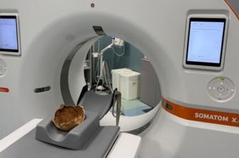 L'analisi del cranio medievale