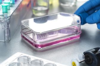 Lo studio sulle cellule tumorali