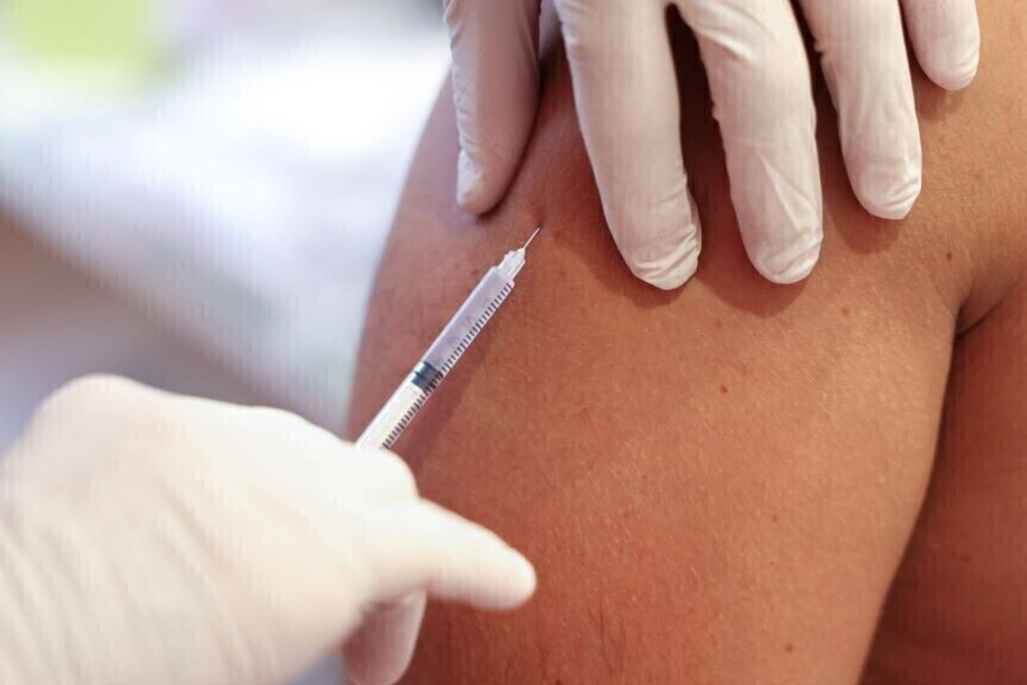 Il vaccino contro l’herpes zoster riduce del 23% il rischio di ictus e patologie cardiache