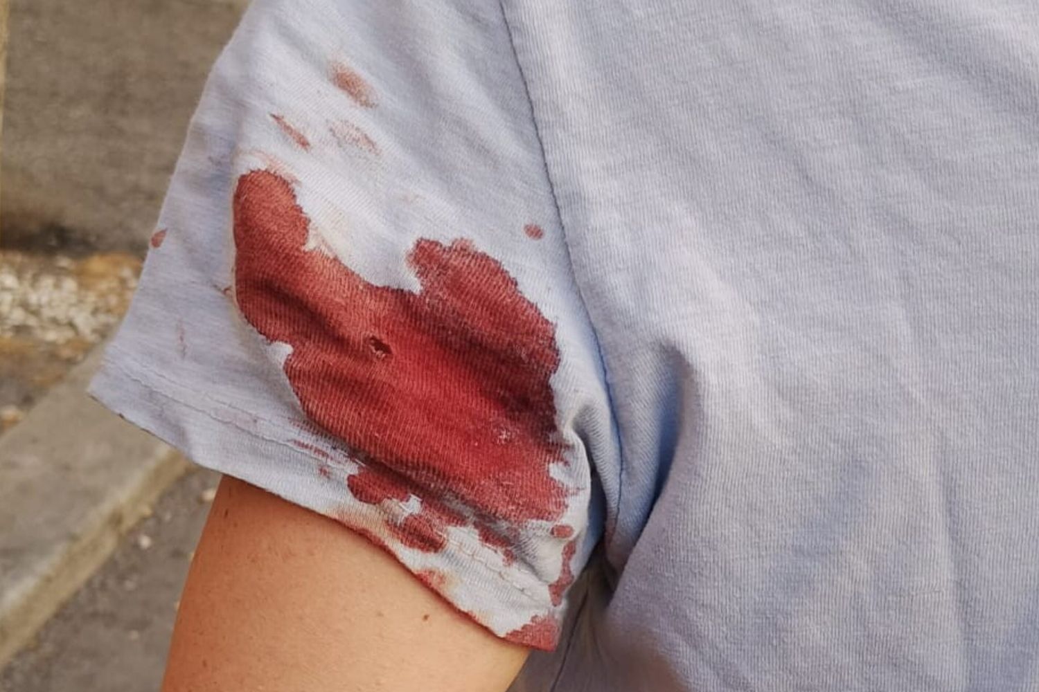 Spari in centro a Roma, ferita una donna a due passi dal Vaticano