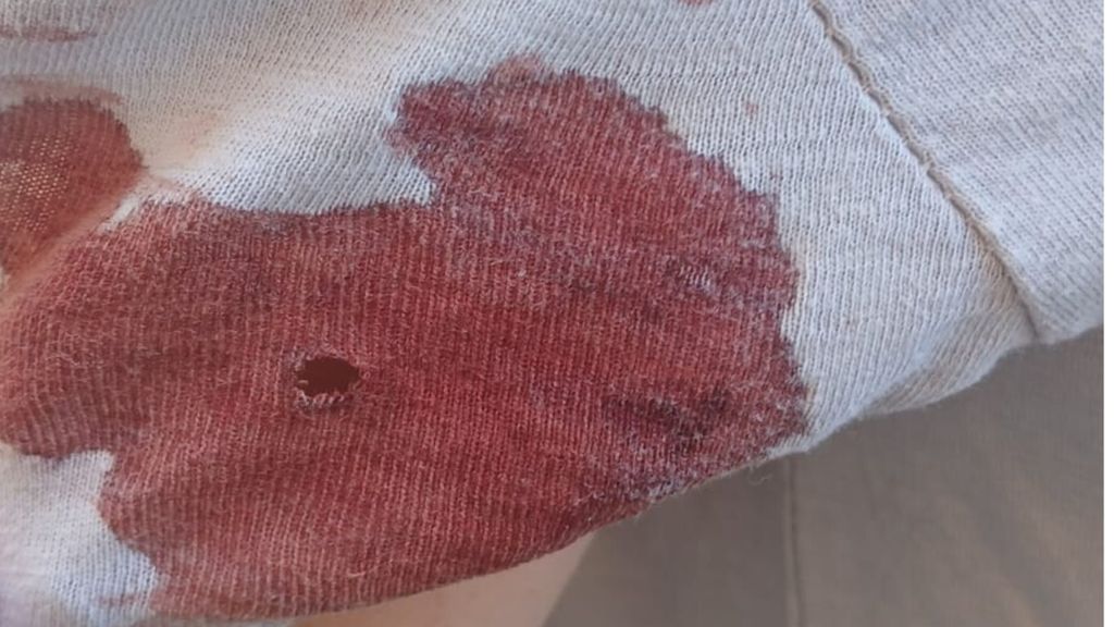 Spari in centro a Roma, ferita una donna a due passi dal Vaticano