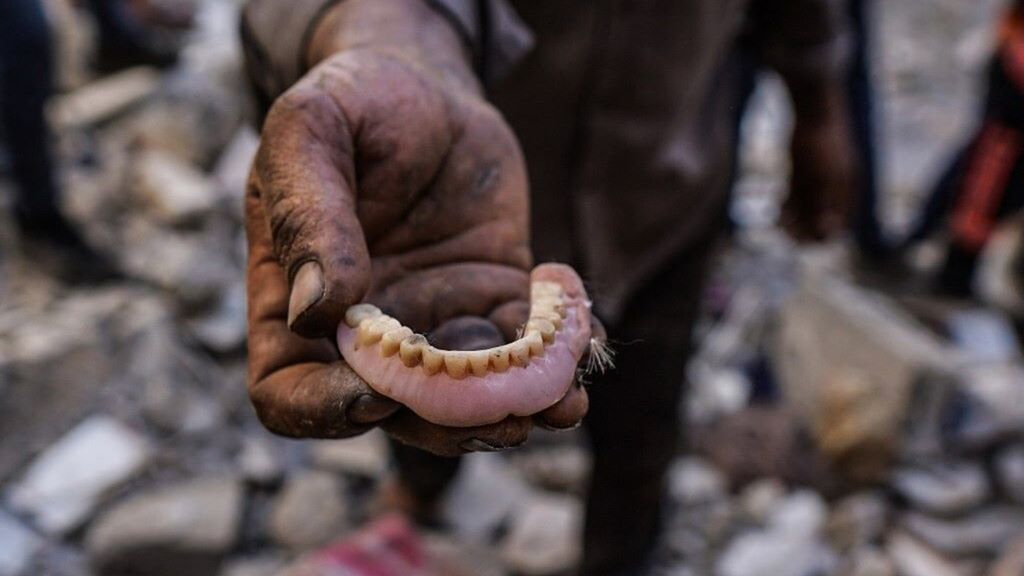 Una mandibola mostrata da un soccorritore a Gaza City  - immagine del 24 settembre 2026