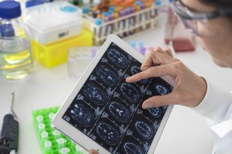 La voce può rivelare l'età biologica del cervello