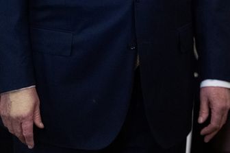 Scolorimento sulla mano del presidente degli Stati Uniti Donald Trump