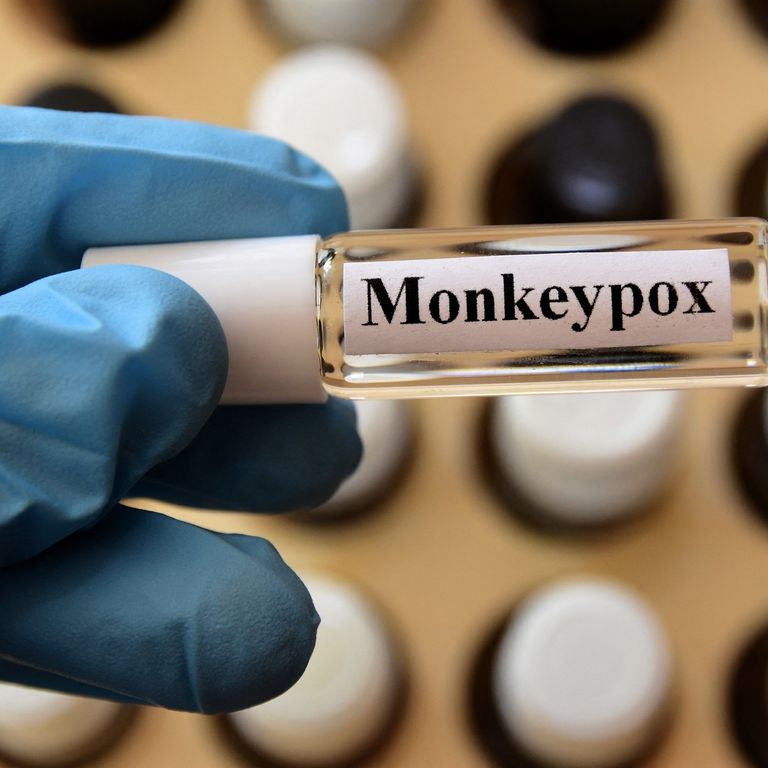 Vaiolo delle scimmie&nbsp;