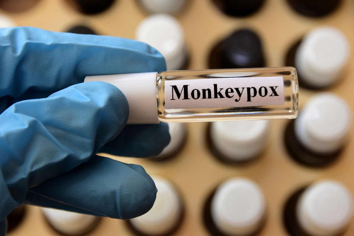 Vaiolo delle scimmie&nbsp;