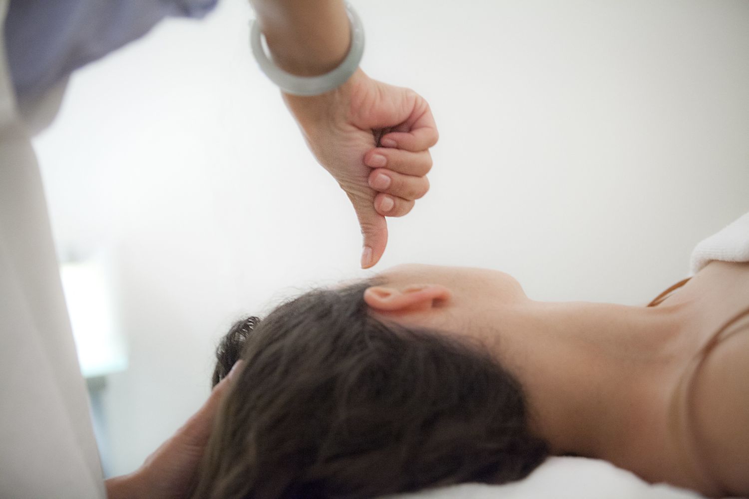 Agopuntura auricolare