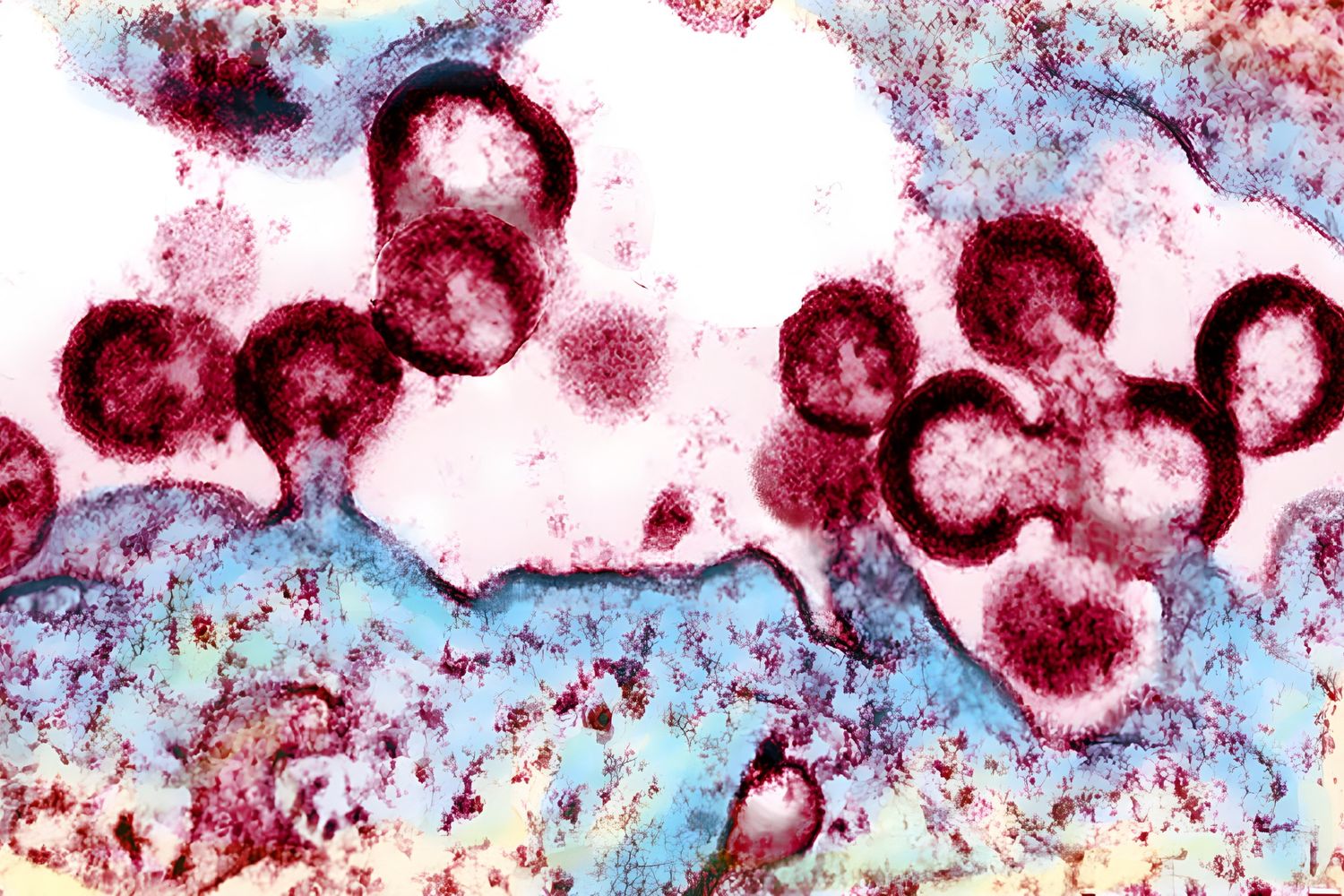 Gemmazione di una cellula positiva all'Hiv&nbsp;