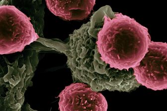 tumori immunoterapia efficace uomini donne studio